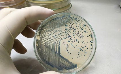 a gloved hand holds a clear dish which contains many blue dots